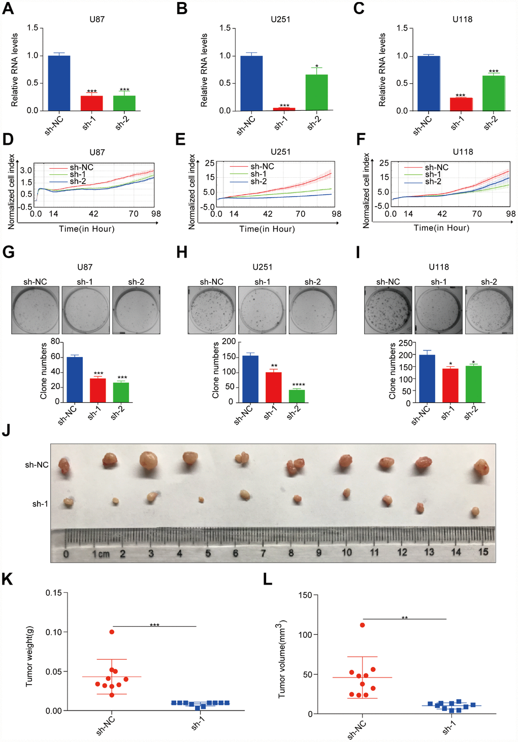 ASPM enhances tumorigenicity of GBM cells in vitro and in vivo. (A–C) RT-qPCR analysis of ASPM expression in stable knockdown U87, U251 and U118 cells. GAPDH was used as an internal reference. sh-NC: shRNA control, sh-1/2: shRNA targeting ASPM. *p D–F) The growth rate of U87, U251 and U118 cells with stable ASPM knockdown was monitored by the RTCA-MP system. (G–I) Colony formation assay was performed using U87, U251 and U118 cells with stable ASPM knockdown. Representative images (up) and quantification analysis (down) are shown, and the data shown are the mean ± SD (n = 3). ***p J–L) ASPM knockdown inhibited tumour growth in the U251 xenograft assay. Photos of xenograft tumours (J), tumour volume (K) and tumour weight (L) are shown. sh-NC, n = 10; sh-1, n = 10. **p 