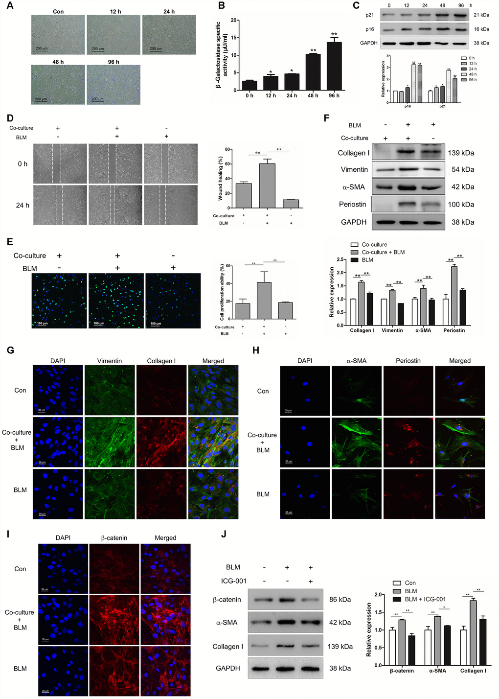 Epithelial cell senescence could induce pulmonary fibroblast activation via activating Wnt/β-catenin signalling. (A–C) MLE-12 cells were treated with bleomycin (BLM, 25 μg/ml) for the indicated times. (A, B) SA-β-gal staining and β-galactosidase activity measurement were performed to detect cellular senescence, * P C) The protein levels of p21 and p16 were measured by Western blot. The expression levels were quantified with ImageJ (n = 3). GAPDH was used as a loading control, *P D–I) MLE-12 cells were pre-treated with or without BLM for 3 days. The medium was replaced by fresh medium without BLM and co-cultured with pulmonary fibroblasts for another 3 days. (D) The migration capacity of pulmonary fibroblasts was detected by using a wound-healing assay. Wound areas were calculated by ImageJ, **P E) The proliferation ability of pulmonary fibroblasts was measured by EdU assay. The percentage of proliferating cells were calculated by ImageJ, **P F) The protein levels of collagen I, vimentin and α-SMA were determined by Western blot. The expression levels were quantified with ImageJ (n = 3). GAPDH was used as a loading control, **P G) Pulmonary fibroblasts were double stained with vimentin and collagen I by immunofluorescence. (H) Pulmonary fibroblasts were double stained with α-SMA and periostin by immunofluorescence. (I) The expression of β-catenin was measured by immunofluorescence. (J) MLE-12 cells were pre-treated with or without BLM for 3 days. MLE-12 cells were cultured with fresh medium without BLM for another 3 days. The supernatants were collected to culture pulmonary fibroblasts in the presence or absence of ICG-001. The expression of β-catenin, α-SMA and collagen I were examined by Western blot. The expression levels were quantified with ImageJ (n = 3). GAPDH was used as a loading control, *P 