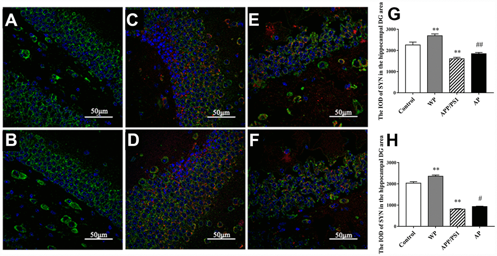 Activation of α7 nAChR attenuates the expression of SYN in the hippocampus of APP/PS1