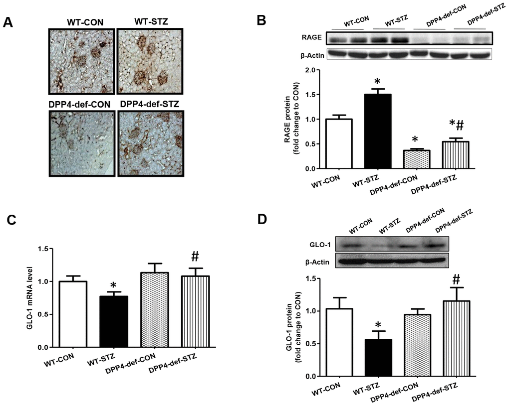 Increased of AGE formation, RAGE and GLO-1 expression are inhibited in the kidney of DPP4 deficient diabetic rats. Kidney samples were collected at 42 days, since over 300 mg/dL of blood glucose after STZ injection as described in Materials and Methods section. AGEs formation was evaluated using antibody against AGEs in the kidney section. Brown color indicates AGEs formation in staining. (A) AGEs formation, (B) RAGE protein level with representative blot (C) GLO1 mRNA level (D) GLO-1 protein level with a representative blot in tissues. WT-CON: wild-type control, WT-STZ: wild-type-STZ, DPP4-def-CON: DPP4-deficient control, DPP4-def-STZ: DPP4-deficient-STZ. Data are shown as the means ± SEM. *p #p 