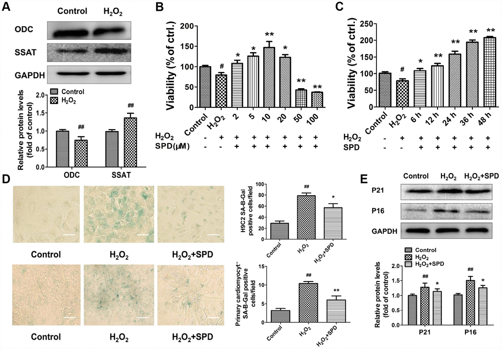 Expression changes in ODC and SSAT and effect of SPD in H2O2- treated cardiomyocytes. (A) Western blot analysis of ODC and SSAT expression in NRCMs treated with or without 40 μM H2O2. GAPDH was used as loading control (n = 4). (B, C) Concentration- and time-dependent effect of SPD on the viability of NRCMs treated with 40 μM H2O2 (n = 8). (D) SA-β-gal staining in NRCMs (top) and H9C2 cells (bottom). The positive area of SA-β-gal staining is shown in the right-hand graph (n = 8). Scale bars: 20 μm. (E) Representative immunoblot bands for p21 and p16, and quantification of protein levels in NRCMs (n = 4). # P ## P * P 2O2, ** P 2O2.