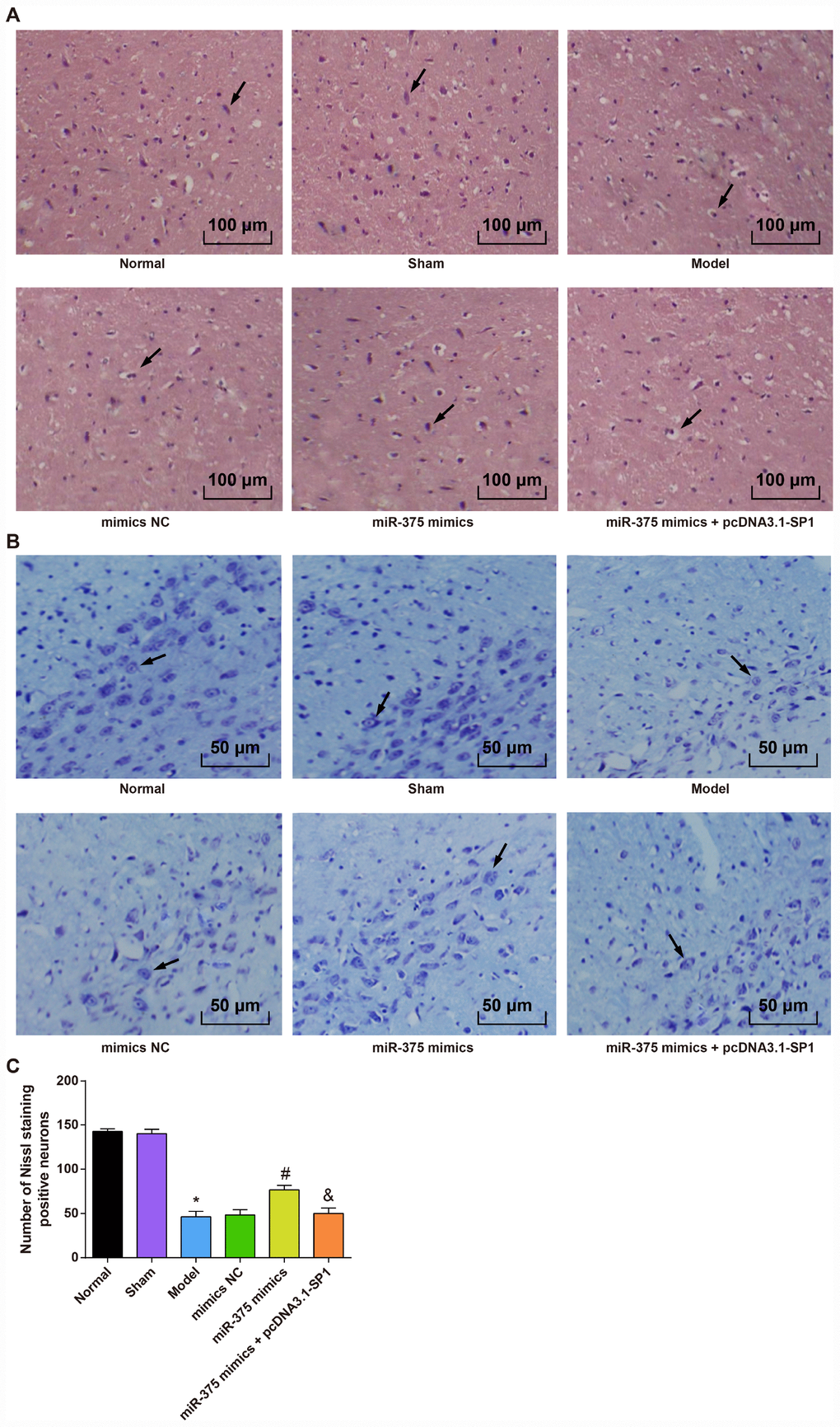 Morphological observation of rats with PD in each group (n = 12). (A) HE staining of substantia nigra in each group (× 100, the arrow indicates the neurons); (B) Nissl staining of substantia nigra in each group (× 200, the arrow indicates the Nissl positive neurons); (C) Comparison of the number of Neuron staining positive neurons in the substantia nigra of rats in each group; * P P P 