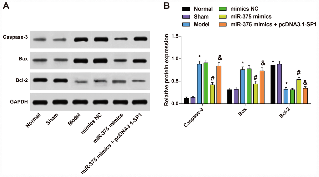 Expression of apoptosis-related proteins Caspase-3, Bax and Bcl-2 in substantia nigra of rats in each group (n = 12). (A) Protein bands of apoptosis-related proteins Caspase-3, Bax and Bcl-2 in substantia nigra of rats in each group; (B) Expression of apoptosis-related proteins Caspase-3, Bax and Bcl-2 in substantia nigra of rats in each group; * P P P 