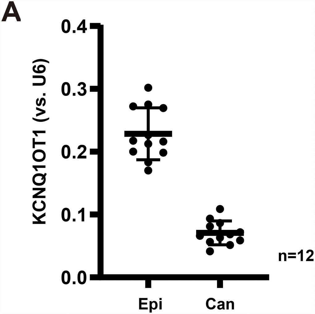 LncRNAKCNQ1OT1 is downregulated in human GC tissues. Expression of LncRNAKCNQ1OT1 (A) in twelve (12) different human gastric cancer (GC) tissues (“Can”) and matched surrounding normal epithelial tissues (“Epi”) was shown, results were normalized to U6 RNA. All values were expressed as the mean ± standard deviation (Same for all Figures). *P vs. “Epi” tissues.