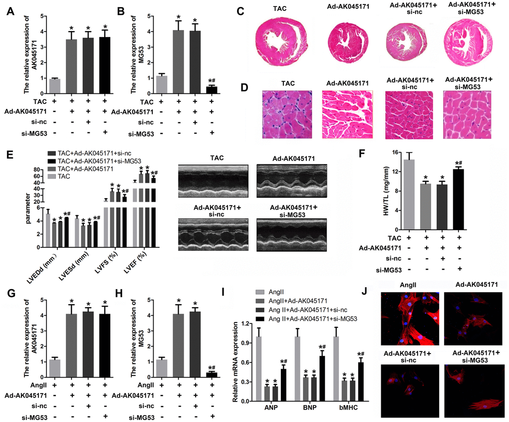 MG53 knockdown reversed the effect of AK045171 on cardiac hypertrophy. (A, B) qPCR was used to evaluate the efficiency of adenoviruses used to induce AK045171 overexpression or knockdown in myocardium and the expression of MG53. (C, D) HE staining of the heart under TAC, TAC+Ad-AK045171, TAC+ shRNA and TAC+sh-MG53 treatment. TAC significantly elevated the level of AK045171 in cardiomyocytes and myocardium. (E) The echoradiographic parameters LVEDP, LVFS, LVEF, and LVESD in mice were evaluated with an ultrasound system. (F) Quantification of heart weight-to-tibial length ratio. (G, H) qPCR was used to evaluate the efficiency of adenoviruses used for AK045171 overexpression and knockdown in cultured cardiomyocytes and the expression of MG53 (I) The level of the myocardial hypertrophy biomarkers ANP, BNP and β-MHC were detected using qPCR. (J) Immunostaining of α-SMA was used to evaluate the size of cardiomyocytes subjected to AngII, AngII+Ad-AK045171, AngII+Ad-AK045171+shRNA or AngII+Ad-AK045171+sh-MG53 treatment.*p# p