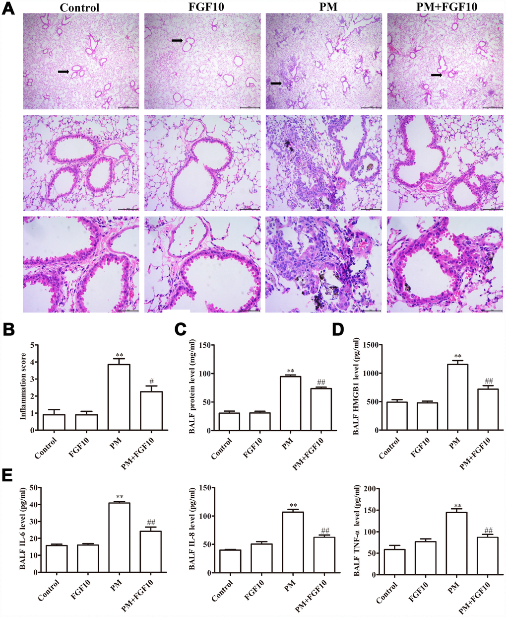 Pretreatment with FGF10 reduced the inflammation in response to PM exposure in vivo. Mice were intratracheally treated with 5 mg/kg of FGF10 solution at one hour in advance, after which these were intratracheally instilled with 100 μg of PM/day/mouse over two consecutive days. (A) The representative H&E stained lung sections. (B) The inflammatory scores for the H&E stained lung sections (n=3/group). (C) The total BALF protein as measured via the BCA assay. (D and E) The BALF HMGB1, IL-6, IL-8 and TNF-α protein levels as quantified by ELISA. Data were presented as mean ± standard error of the mean (SEM, n=3); *PPvs. control. #P##Pvs. PM.