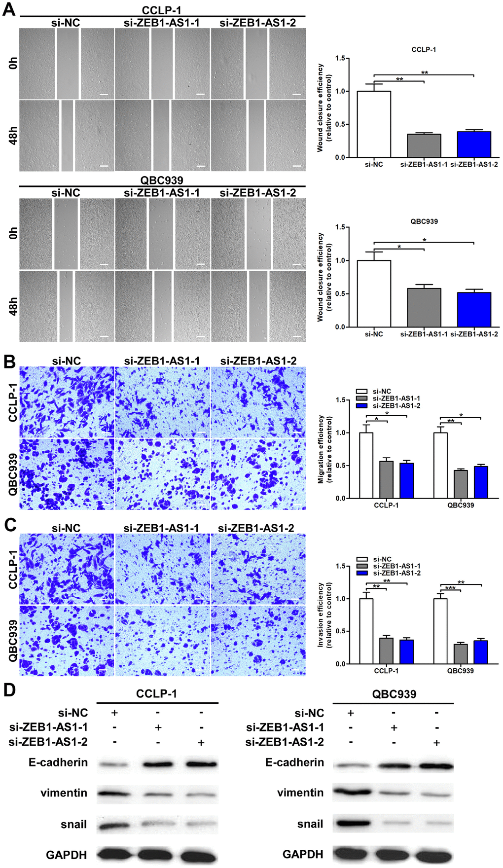 Upregulated ZEB1-AS1 promoted cellular migration and invasion through promoted EMT process. (A) The wound closure of QBC939 and CCLP-1 cells transfected with si-ZEB1-AS1-1 and si-ZEB1-AS1-2 was delayed verified by wound healing assays. (B) The numbers of migrating cells were decreased in si-ZEB1-AS1 cells. (C) Transwell assays displayed that knocking down ZEB1-AS1 inhibited invasion of QBC939 and CCLP-1 cells compared with controls. (D) EMT-related proteins including epithelial marker (E-cadherin) and mesenchymal markers (snail and vimentin) were measured via western blot. *P **P ***P 