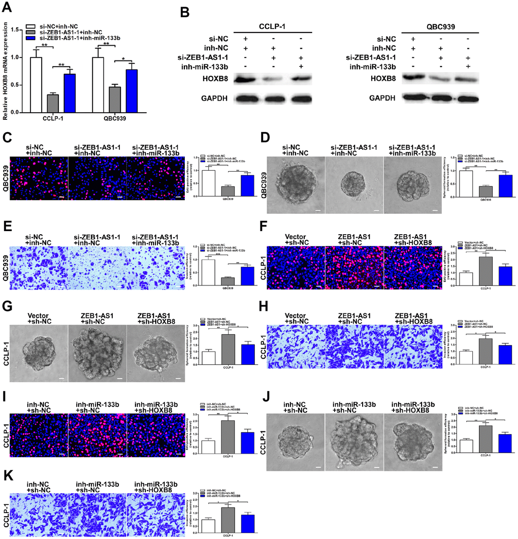 ZEB1-AS1 promoted malignant progression of CCA through mediating miR-133b/HOXB8. (A, B) HOXB8 downexpression caused by ZEB1-AS1 knockdown was saved by silencing miR-133b. (C–E) Rescue assays of EdU, spheroid formation and transwell confirmed that inhibition of proliferation, stemness and invasion induced by knocking down ZEB1-AS1 was saved through silencing miR-133b, respectively. (F–H) CCLP-1 cells cotransfected with pcDNA3.1-ZEB1-AS1 and sh-HOXB8 were used to carry out EdU, spheroid formation and transwell assays, respectively. (I–K) Restoration of HOXB8 expression rescued the promotion of proliferation, stemness and invasion generated through miR-133b knockdown in EdU, spheroid formation and transwell assays, respectively. *P **P ***P 