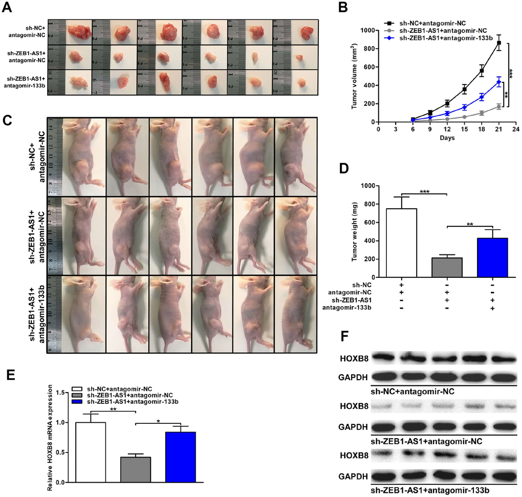 ZEB1-AS1/miR-133b/HOXB8 contributed to CCA tumorigenesis in vivo. (A) Xenograft tumors were resected on the 21st day after injection. (B) Tumor volumes were calculated every 3 days throughout the course of tumor growth. (C) CCLP-1 cells cotransfected with sh-ZEB1-AS1 and antagomir-133b were subcutaneously injected into the posterior flanks of mice. (D) Tumor weights were measured after excision. (E, F) HOXB8 expression in xenograft tumors of the three groups (sh-NC/antagomir-NC, sh-ZEB1-AS1/antagomir-NC, sh-ZEB1-AS1/antagomir-133b). *P **P ***P 