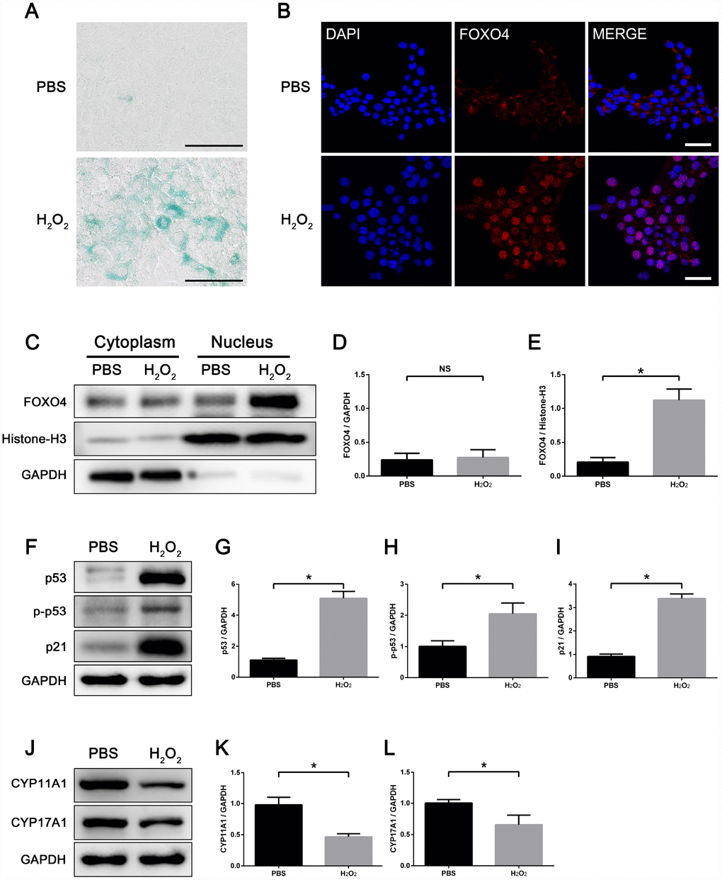 H2O2 induces FOXO4 nuclear translocation and cellular senescence in TM3 Leydig cells. (A) SA-β-gal assay showing TM3 Leydig cells with increased SA-β-gal activity after 48 h exposure to 100 μΜ H2O2 in serum-free medium. Scale bar: 100 μm. (B) Immunofluorescent staining showing that H2O2-induced senescent TM3 Leydig cells express FOXO4 predominantly in the nucleus, while controls express FOXO4 in the cytoplasm. Scale bar: 50 μm. (C–E) Western blots of separating nuclear and cytoplasmic extracts showing a significant increase in FOXO4 expression in H2O2-induced senescent TM3 Leydig cells, and FOXO4 concentrated in the nucleus. (F–I) Western blots of total protein revealing the levels of p53, Ser15-phopho-p53 and p21 are significantly elevated in H2O2-induced senescent TM3 Leydig cells. (J–L) Western blots revealing that levels of the testosterone synthesis-related proteins CYP11A1 and CYP17A1 are significantly decreased in H2O2-induced senescent TM3 Leydig cells. Data presented are representative of three independent experiments. Data depict the mean ± SD. *P