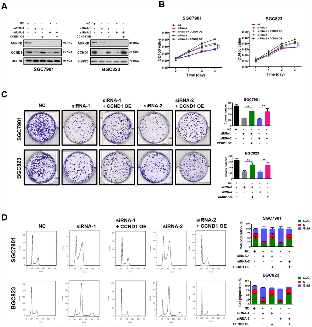 Restoration of CCND1 abrogated the inhibition of cell growth mediated by AURKB-siRNAs. (A) Western blot showing the restoration of CCND1 expression in SGC7901 and BGC823 cells transfected with AURKB siRNA or negative control siRNA. HSP70 was the loading control. (B) Enforced expression of CCND1 significantly abrogated the inhibition of proliferation mediated by AURKB siRNA in SGC7901 and BGC823 cells, as evidenced by CCK-8 assays. The results shown are the means ± SDs of three independent experiments; **, P C) Enforced expression of CCND1 significantly abrogated the inhibition of colony formation mediated by AURKB siRNA in SGC7901 and BGC823 cells. Left panel, representative images from colony formation assays. Right panel, the number of colonies formed by the indicated cells was quantified. Data are presented as the means ± SDs; **, PD) Enforced expression of CCND1 significantly abrogated the cell cycle arrest in G2/M phase mediated by AURKB siRNA in SGC7901 and BGC823 cells. Right panel, bar graphs showing the percentages of SGC7901 and BGC823 cells in the G0/G1, S and G2/M phases. Each histogram bar represents the mean ± SD of three independent experiments.