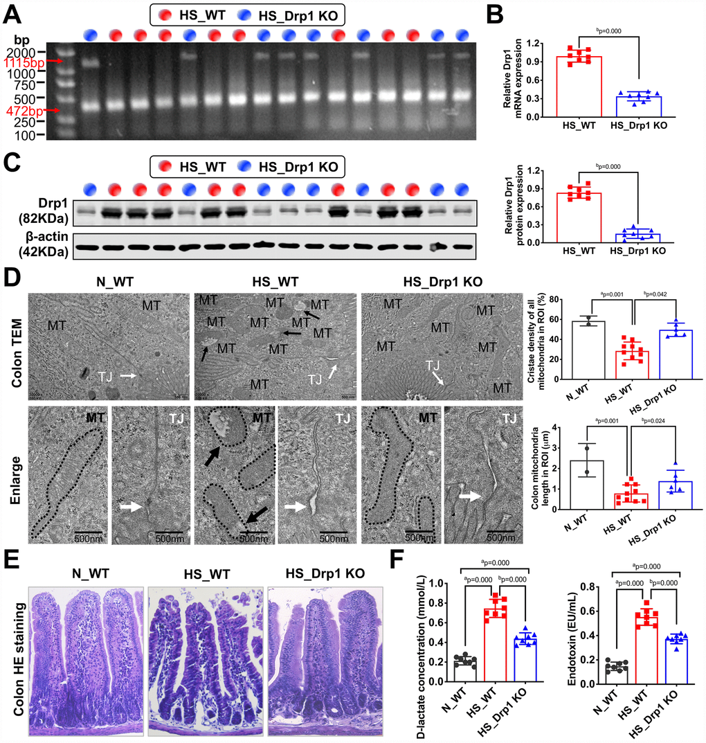 The effects of Drp1 on intestinal barrier function after shock. (A) The genotype identification results of Drp1 KO and WT mice. The genotype of Drp1 KO mice (blue dot, n=8) is Drp1 +/- (double bands at 1115 bp and 472 bp), and the genotype of WT mice (red dot, n=8) is Drp1 +/+ (single band at 472 bp). (B) Drp1 mRNA expression in colon tissues of HS