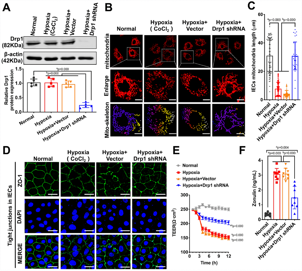 The effects of Drp1 on intestinal epithelial tight junction after hypoxia. (A) Drp1 protein expression in hypoxia-treated IECs after Drp1 shRNA (n=5). (B) Mitochondrial morphology in hypoxia-treated IECs after Drp1 shRNA. (Bar, 25μm). The mitochondria skeletons are analyzed by Image J software. (C) The length of mitochondria skeletons of IECs in each group. 69 mitochondria skeletons are observed and measured by Image J software in Normal group, 139 mitochondria in Hypoxia group, 118 mitochondria in Hypoxia+ Vector group and 35 mitochondria in Hypoxia+Drp1 shRNA group. (D) Tight junctions (ZO1) of IECs in each group detected by immunofluorescence. (Bar, 50μm). (E) The TEER value of monolayer IECs in each group. The observation time lasts 12 hours and measures every 1 hour (n=5). (F) The Zonulin content in supernatant of IECs in each group (n=8). a represents p 