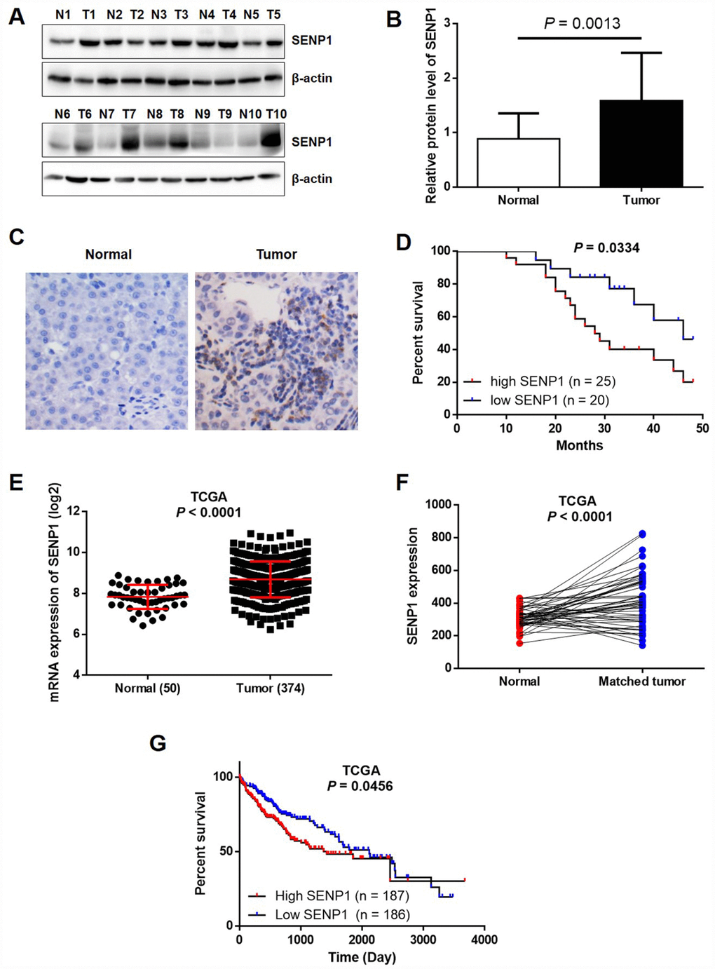 SENP1 is overexpressed in HCC tissues. (A) The protein levels of SENP1 in adjacent normal tissues and tumor tissues were examined by Western blot. (B) The average relative protein levels of SENP1 in adjacent normal tissues and tumor tissues obtained from gray analysis of Western blot results. (C) The expression of SENP1 in adjacent normal tissues and tumor tissues was determined by immunohistochemical staining. (D) Kaplan-Meier’s analysis of the correlation between SENP1 levels and overall survival in HCC patients. (E, F) SENP1 expression in TCGA RNAseq database. (G) The association between SENP1 expression and survival rate in TCGA database. The representative images were selected from at least three independent experiments.