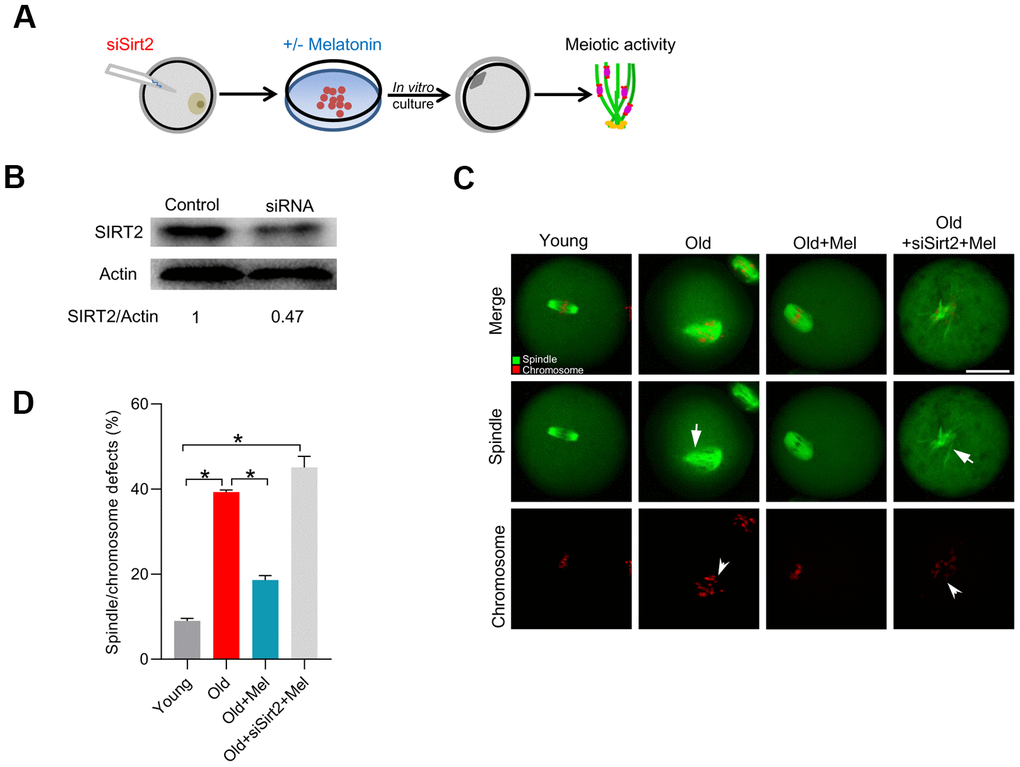 SIRT2 knockdown abolishes the effects of melatonin on meiotic phenotypes in aged oocytes. (A) Schematic illustration of the experimental protocol to check whether SIRT2 mediates the effects of melatonin on aged oocyte. (B) The efficiency of SIRT2 knockdown was verified by Western blot. Actin served as a loading control. Band intensity was calculated using ImageJ software. (C) Representative images of spindle/chromosome organization in young, old, old+Mel and old+Mel+siSirt2 oocytes are shown. Arrows indicate the disorganized spindle and arrowheads indicate the misaligned chromosomes. (D) Quantification of young, old, old+Mel and old+Mel+siSirt2 oocytes with abnormal spindle/chromosomes. Error bars indicate ± SD. *P