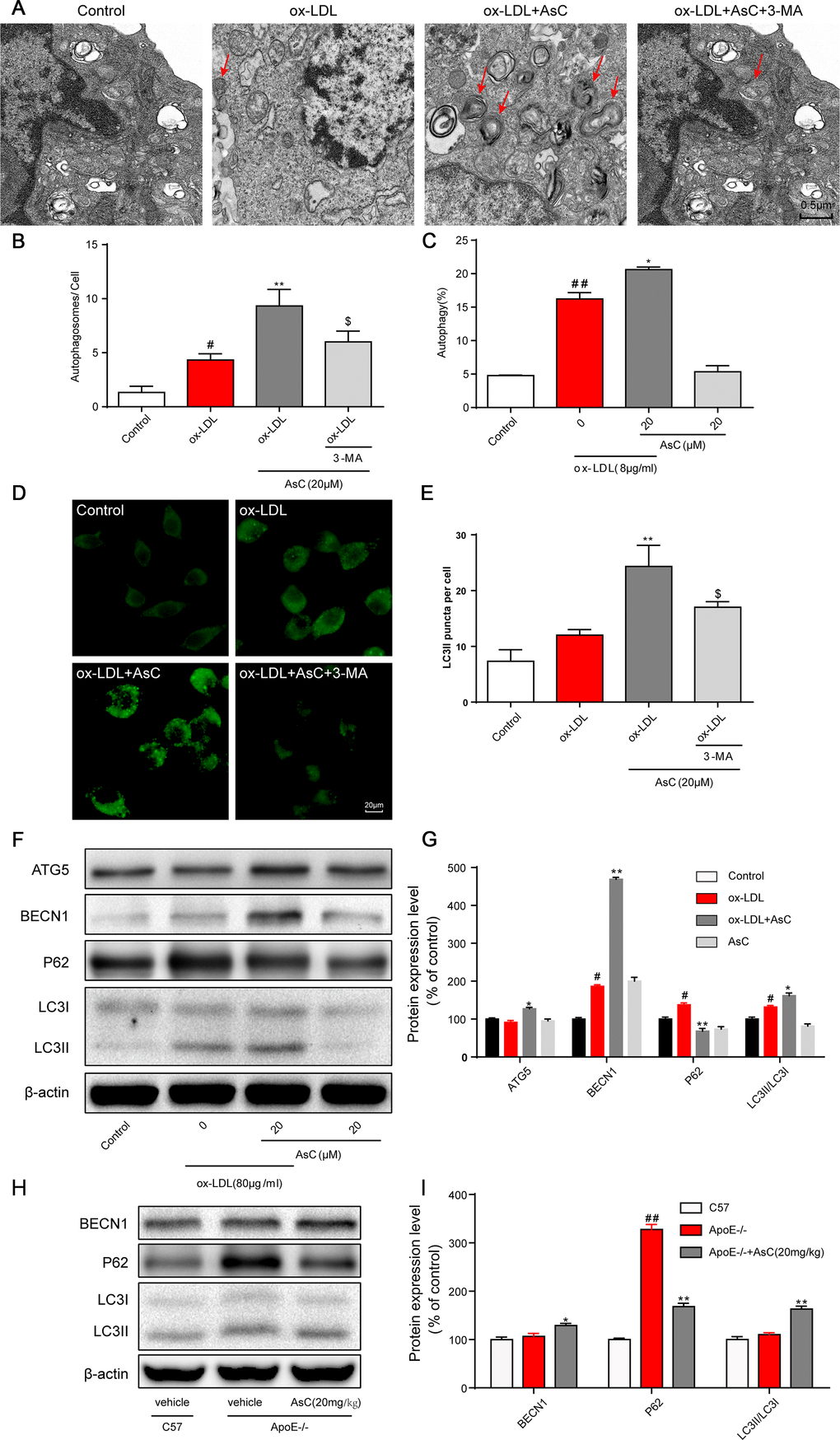 AsC induced macrophage autophagy. RAW264.7 cells were pretreated with 3-MA (5 mM) for 2 h, treated with AsC (20 μM) for 12 h, and then exposed to ox-LDL for another 24 h. (A) Representative photographs of autophagosomes (red arrows) examined using a JEOL JEM1230 electron microscope. (B) Statistical results of autophagosomes. (C) Summarized data showing the percentage of cells that were positive for CytoID fluorescence, as detected by flow cytometry analysis. (D) Representative photographs of LC3II staining. (E) Statistical results of LC3II-positive cells. (F) Representative photographs of ATG5, BECN1, P62, LC3 and β-actin expression in ox-LDL-treated macrophages, as evaluated by western blot analysis. (G) Statistical results of ATG5, BECN1, P62, LC3II/LC3I expression levels compared with those in the control group. (H) Representative photographs of BECN1, P62, LC3 and β-actin expression in aortic lysates. (I) Statistical results of BECN1, P62, LC3II/LC3I expression levels compared to those in the control group. The data are presented as the means ± SDs (n = 5). #P ##P vs. the control group, *P **P vs. the model group; $P vs. the ox-LDL and AsC group.