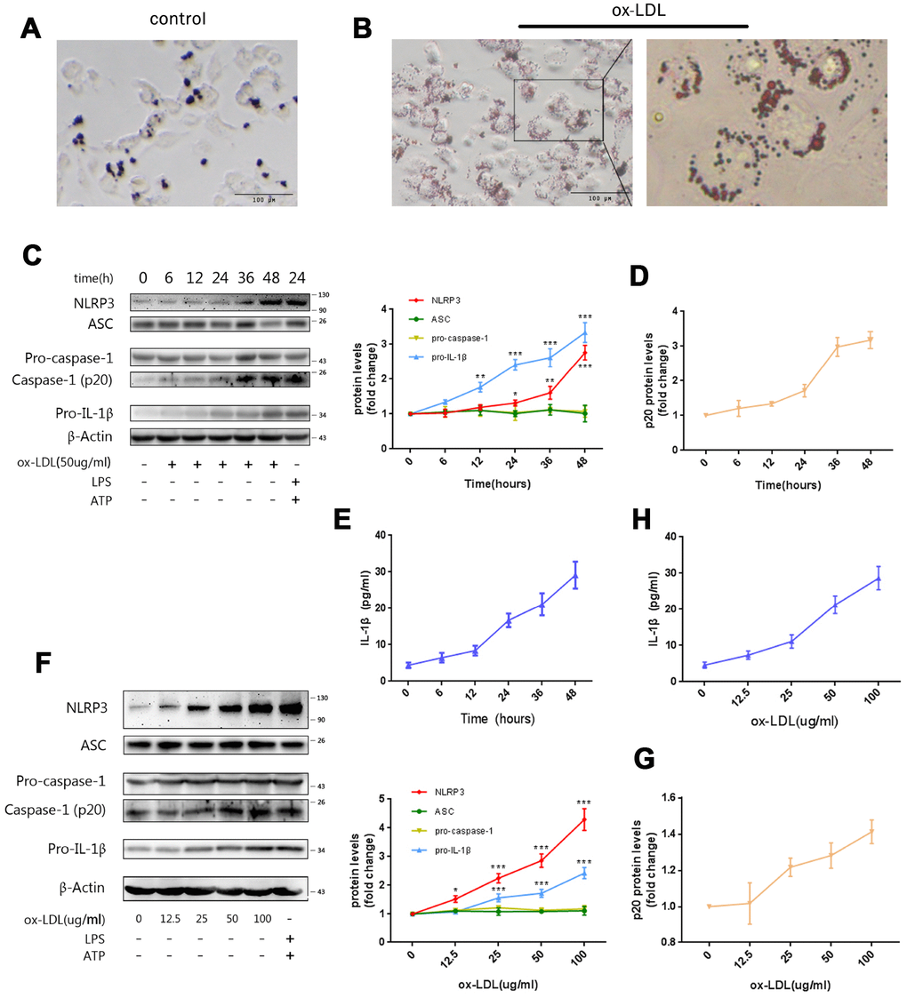 Ox-LDLs activate NLRP3 inflammasomes in a time- and dose-dependent manner. (A and B) Representative Oil Red O staining images of Mφ treated with (B) or without (A) ox-LDLs. The right image in (B), 4× enlargement of the outlined area at the left. Scale bars, 100 um. (C) The immunoblot analysis of lysates of Mφ treated with ox-LDLs (50 ug/ml) for a series of time intervals. (C and D) The densitometric analysis of the NLRP3, ASC, pro-caspase-1, pro-IL-1β (C) and p20 (D) signal vs. time, which was normalized to β-actin. (E) The ELISA of IL-1β in supernatants obtained from (C). (F) The immunoblot analysis of lysates of Mφ treated with various doses of ox-LDLs for 24 hours. (F and G) The densitometric analysis of the NLRP3, ASC, pro-caspase-1, pro-IL-1β (F) and p20 (G) signal vs. ox-LDL concentrations, which were normalized to β-actin. (H) The ELISA of IL-1β in supernatants obtained from (F). The data are presented as mean ± SD (n=3); * denotes statistical significance by one-way analysis of variance (ANOVA) with post hoc Dunnett’s multiple comparisons test when compared to 0 hour or 0 ug/ml ox-LDLs. *PPP