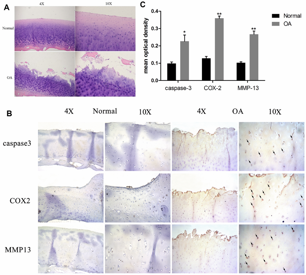 Chondrocyte apoptosis, inflammation, and matrix degradation in the OA samples. (A) Representative images of H&E staining; (B) Representative images of immunohistochemistry; (C60) Quantitative optical density analysis of immunohistochemistry. Data represent the mean ± SD (n=5) and were analyzed by one-way analysis of variance followed by Tukey's post hoc test. ** p p 