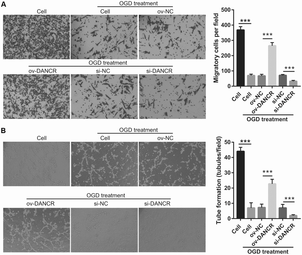 DANCR overexpression promotes migration and angiogenesis in OGD-treated BMECs. (A) Representative image of the migration (scale bar: 200×) measured transwell after transfection at 48 h followed by OGD treatment for 4 h. The bar represents migratory cells. (B) Representative image of angiogenesis (scale bar: 200×) measured by tube formation assay after transfection at 48 h followed by OGD treatment for 4 h. The bar represents the number of meshes. ***P
