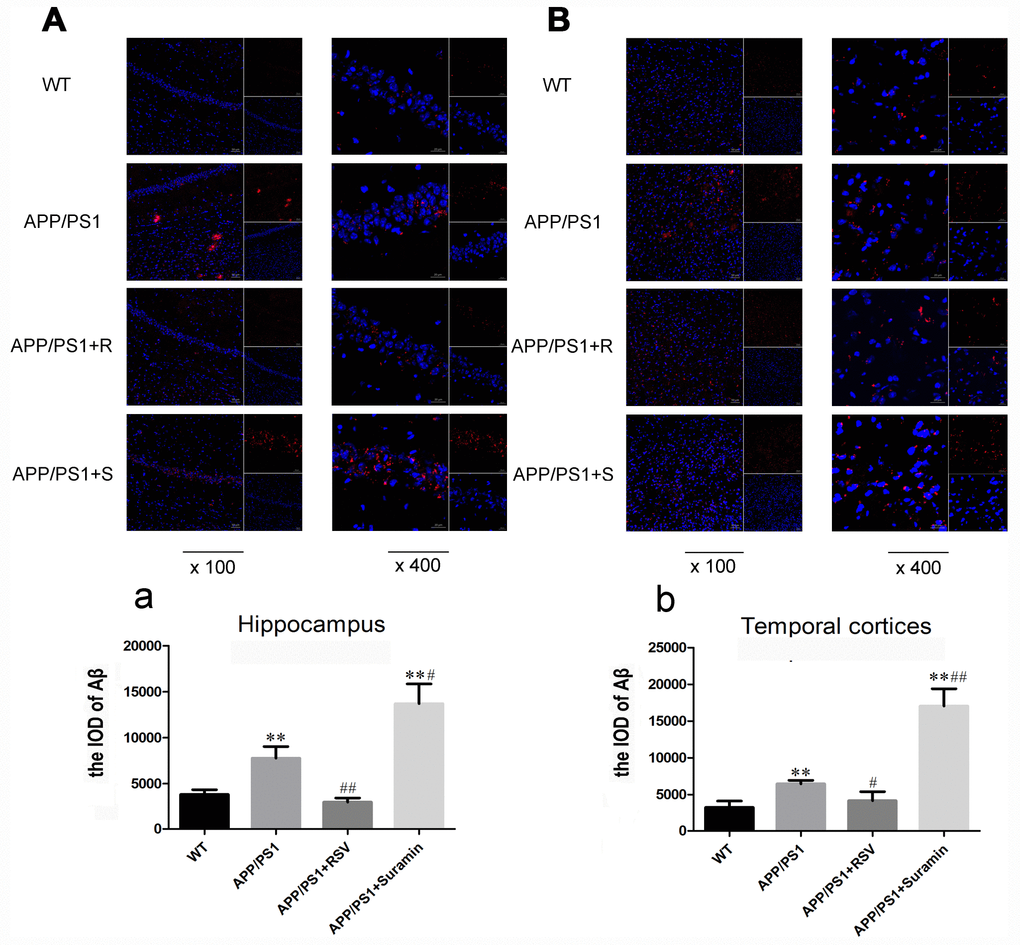 Effects of RSV and suramin on the level of Aβ in mouse brain, as determined by confocal laser scanning. The wild-type (WT) animals received physiological saline (PS) and APP/PS1 mice RSV (APP/PS1+R): 20 mg/kg or suramin (APP/PS1+S): 20 mg/kg by gavage once daily for two months. (A) Aβ deposits in the hippocampus (×100 and ×400). (a) The integral optical density (IOD) of Aβ in the hippocampus. (B) Aβ deposits in the temporal cortices (×100 and ×400). (b) The IOD of Aβ in the temporal cortices. The values presented are means ± SD. *PP#P##P