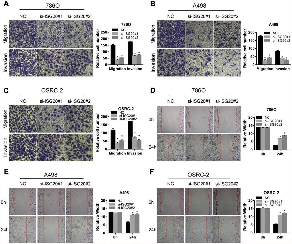 ISG20 improved the migration and invasion abilities of ccRCC cells in vitro. (A–C) Transwell assays analysis of the effect of ISG20 knockdown on cell migration and invasion. (D–F) Wound healing assays analysis of the effect of ISG20 knockdown on the migration of ccRCC cells. ccRCC: clear cell renal cell carcinoma. Data are represented as mean ± SD. ***, P 