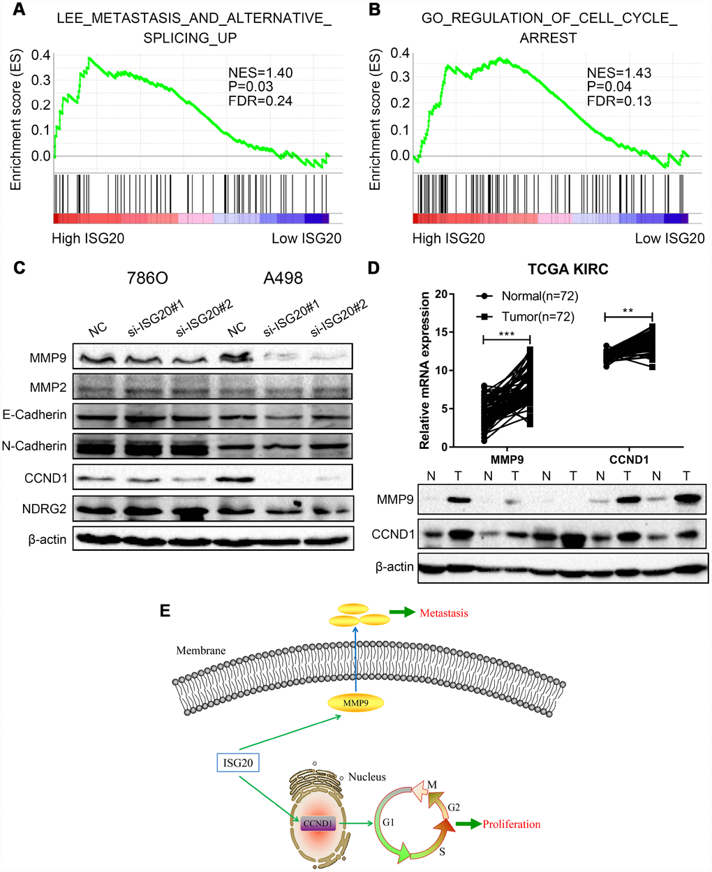 ISG20 positively regulated the expression of MMP9/CCND1 in ccRCC. (A–B) GSEA revealed that the high ISG20 expression group was associated with metastasis pathways and cell cycle pathways. (C) The expression of MMP9 and CCND1 were down-regulated in ccRCC cells with knockdown of ISG20. (D) The expression of MMP9 and CCND1 were elevated in the TCGA KIRC dataset and ccRCC tissues. (E) The schematic representation of elevated the expression of ISG20 could drive tumor progression via up-regulating the expression of MMP9/CCND1. ccRCC: clear cell renal cell carcinoma; TCGA KIRC: The Cancer Genome Atlas Kidney Clear Cell Carcinoma. Data are represented as mean ± SD. ***, P 