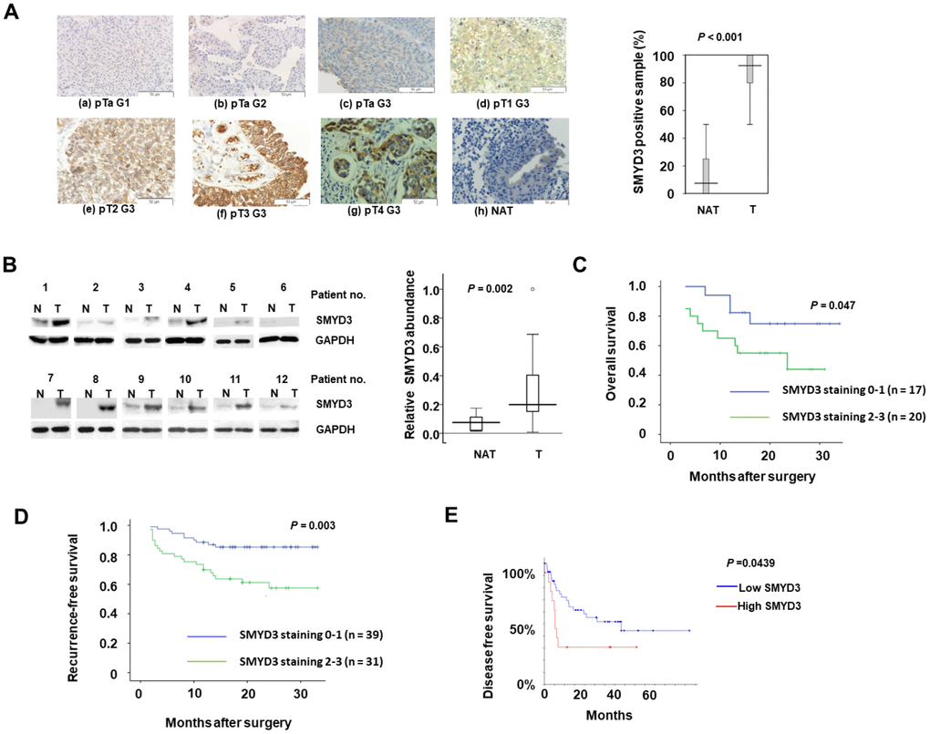 SMYD3 is upregulated in BC tumors and serves as a poor prognostic indicator of BC. (A) SMYD3 expression in representative BC tumors (T) and NAT (please define NAT: non-cancerous adjacent tissues?) (n=65) analyzed using IHC (Magnification: ×200). The Tukey box-and whiskers plot shows the percentage of positive IHC staining SMYD3 in 65 BC tumors and NAT. A set of Wilcoxin tests for paired groups was used to calculate the two-sided P values. (a-g: BC tumors; h: NAT of f). (B) Representative images of Western blot analysis of SMYD3 expression in 25 pairs of frozen BC tumors (T) and corresponding non-cancerous bladder tissues (N). The Tukey box-and whiskers plot shows the quantification of the Western blot signals. A set of Wilcoxin tests for paired samples was used to calculate the two-sided P values. (C) Kaplan-Meier plot comparing survival of BC patients undertaken radical cystectomy based upon SMYD3 expression. Statistical significance was determined by log-rank test. (D) Kaplan-Meier plot comparing survival of recurrence of BC patients undertaken TURBT (Define it) based upon SMYD3 expression. Statistical significance was determined by log-rank test. (E) Kaplan-Meier plot comparing DFS of BC patients according SMYD3 mRNA abundance from the TCGA dataset and analyses were described in Materials and Methods. Statistical significance was determined by log-rank test.