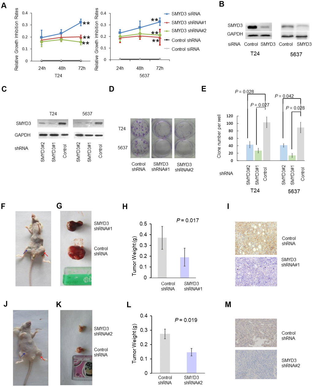 SMYD3 is required for tumorigenecity of T24 and 5637 cell lines. (A) A CCK-8 assay was performed to measure the growth rate of T24 and 5637 cells at 24, 48 and 72 h post SMYD3 siRNA treatment or shRNA vector transfection. Three independent transfections were performed in triplicate. Two-way ANOVA test were used to calculate the two-sided P values. ** P B) Western blot analysis of SMYD3 protein expression in T24 and 5637 cells transfected with SMYD3 siRNA for 72 h (n=3). (C) Western blot analysis of SMYD3 expression in BC cells stably transfected with the SMYD3 shRNA vector #1, #2 or control vector. GAPDH served as a loading control (n=3). (D) Representative images of clonogenic assays of the T24 and 5637 cell lines stably expressing SMYD3 shRNA #1 and #2 or control shRNA. Briefly, 200 cells/well (in 6-well plates) were incubated for 14 days (n=6). (E) Quantification of clonogenic assays for 6 independent transfections. Wilcoxon signed-rank tests for paired samples were used to calculate the two-sided P values. (F–M) Xenograft model of BC in nude mice. T24 (F–I) and 5637 (J–M) Cells stably expressing SMYD3 shRNA or control shRNA were injected subcutaneously into BALB/c nude mice in the inguinal area (n = 8), and tumor sizes, weights and morphology were evaluated 6 weeks after injection. (F, J) Representative nude mice injected with BC cells expressing SMYD3-shRNA (blue arrow) or Control shRNA (red arrow). (G, K) Representative tumors derived from BC cell-injected nude mice. (H, L) Tumor weights of BC cells expressing SMYD3-shRNA or con-shRNA (t-test). (I, M) IHC of tumor sections from cell-injected nude-mice using SMYD3 antibody; representative staining is shown. Bars: standard deviations (SD).