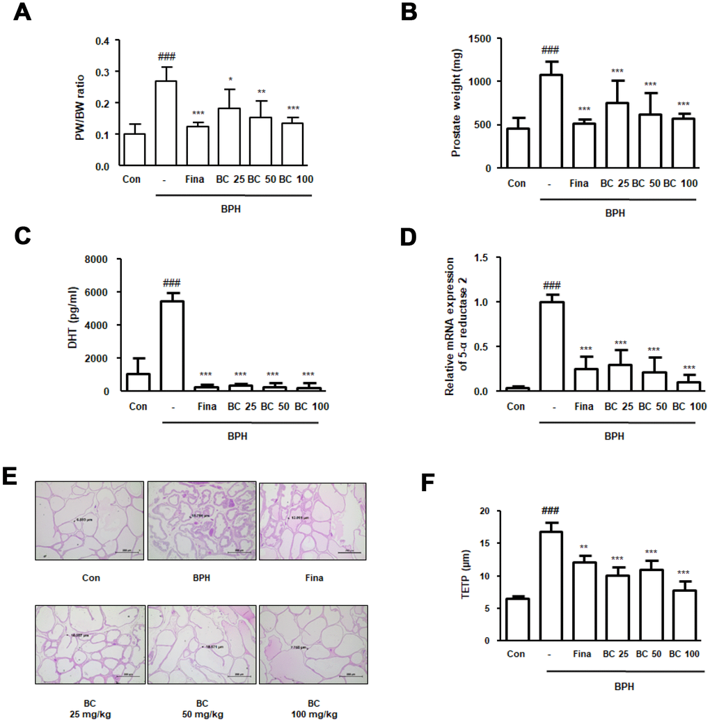 Effect of BC on prostatic enlargement by inhibition of 5α-reductase Type II in TP-treated BPH rat model. Animals were injected with TP for 4 weeks with or without Fina and various concentration of BC. (A) Prostate weight to body weight (PW/BW) ratio and (B) prostate weight in each group were assessed. PW/BW ratio was calculated as (average prostate weight of the experimental group/ average body weight of the experimental group) × 1000. (C) DHT serum concentrations were analyzed using ELISA kit. (D) 5α-reductase Type II mRNA expression was showed by qRT-PCR analysis in prostatic tissues. (E) H&E staining analysis was performed using prostatic tissue sections. Original magnification 100x. (F) Based on H&E staining, TETP was measured and represented. All data are shown as the average value of each experimental group and are mean ± SD (n = 8). P value ### = P 