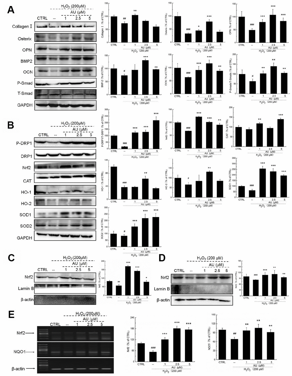 AU protected the H2O2-caused MG63 cells apoptosis via regulation the Nrf2/HO-1 signaling. (A) AU up-regulated the expression levels of osteoblast differentiation related proteins including Osterix, OPN, BMP2, OCN and P-Smad in MG63 cells exposed to H2O2. (B) AU increased the expression levels of proteins within the Nrf2/HO-1 signaling including P-DPR1, Nrf2, CAT, HO-1, HO-2, SOD-1 and SOD-2 in MG63 cells exposed to H2O2. AU enhanced the expression levels of Nrf2 in both (C) nucleus and (D) cytoplasm of MG63 cells exposed to H2O2. The quantification data of proteins were normalized by corresponding GAPDH and total proteins, respectively (n=4). (E) AU increased the mRNA levels of Nrf2 and NQO-1 in MG63 cells exposed to H2O2. Marker size from top to bottom: 1000 bp, 700 bp, 500 bp, 400 bp, 300 bp, 200 bp and 100 bp. The data on quantified mRNA expression were normalized to the levels of β-actin (n=4). Data are expressed as mean ± S.D. and analyzed using a one-way ANOVA. # PPPvs. control cells, *PPPvs. Dex-exposed cells.