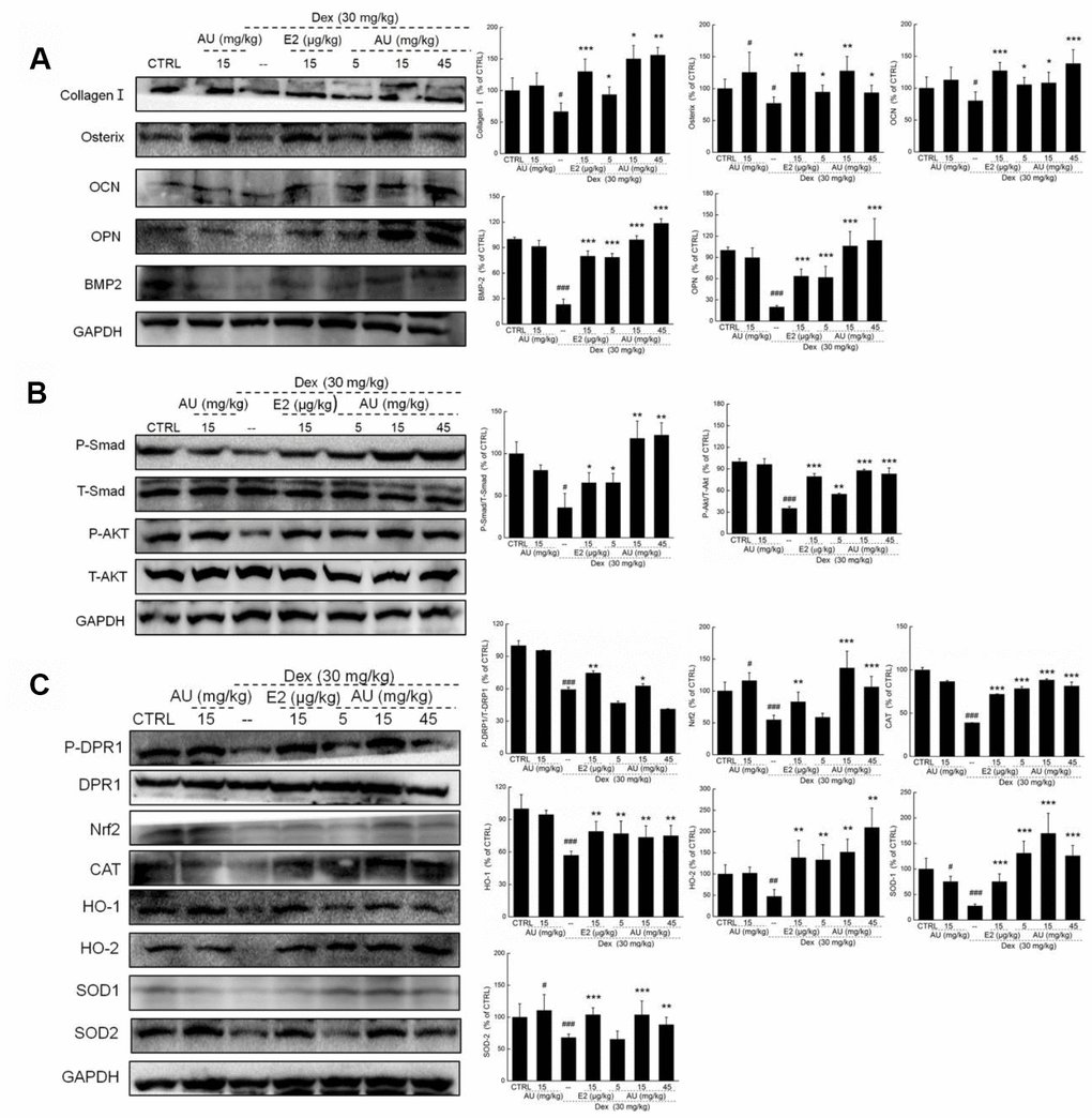 AU enhanced the osteoblast differentiation of femoral bone in Dex-ineduced osteoporotic mice. (A) AU enhanced the expression levels of osteoblast differentiation related proteins including collagen I, Osterix, OCN, OPN, BMP2, and P4HB in femoral bone tissues of Dex-ineduced osteoporotic mice. (B) AU enhanced the expression levels of P-Smad and P-Akt in femoral bone tissues of Dex-ineduced osteoporotic mice. (C) The effects of AU on the expression levels of Nrf2/HO-1 signaling related proteins in femoral bone tissues of Dex-ineduced osteoporotic mice, including P-DRP1, Nrf2, CAT, HO-1, HO-2, SOD-1, SOD-2, P-Smad and P-Akt. The quantification data of proteins were normalized by corresponding GAPDH and total proteins, respectively, expressed as mean ± S.D. (n=6) and analyzed using a one-way ANOVA. # PPPvs. CTRL mice, *PPP