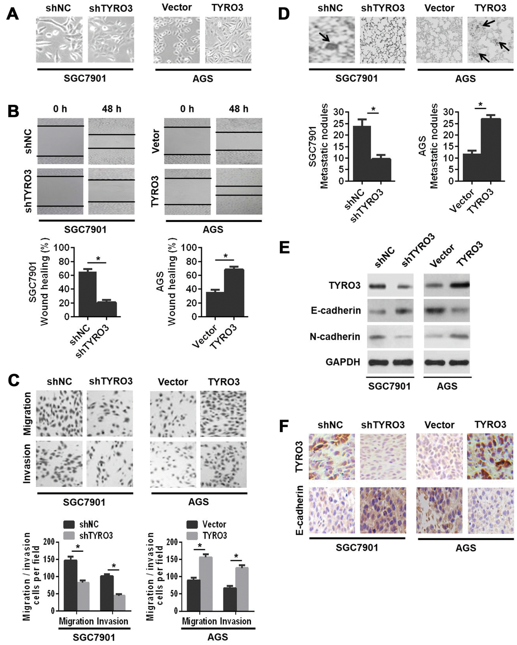 The effects of TYRO3 downregulation or upregulation on gastric cancer (GC) cell migration and invasion in vitro and metastasis in vivo. (A) Representative images of TYRO3 downregulation or upregulation-induced morphological changes of GC cells. (B) The effects of TYRO3 downregulation or upregulation on the migratory capability of GC cells using the wound-healing assay. (C) The effects of TYRO3 downregulation or upregulation on the migratory and invasive capabilities of GC cells using the Transwell assay. (D) Representative hematoxylin and eosin staining images of lung metastases. Metastatic tumor nodules are indicated by black arrows. (E) Western blot analyses of the expression levels of TYRO3, E-cadherin, and N-cadherin in the lung metastatic nodules. (F) Immunohistochemical detection of the expression levels of TYRO3 and E-cadherin in the lung metastatic nodules (n = 6/group). Glyceraldehyde 3-phosphate dehydrogenase was used as a loading control. *P 