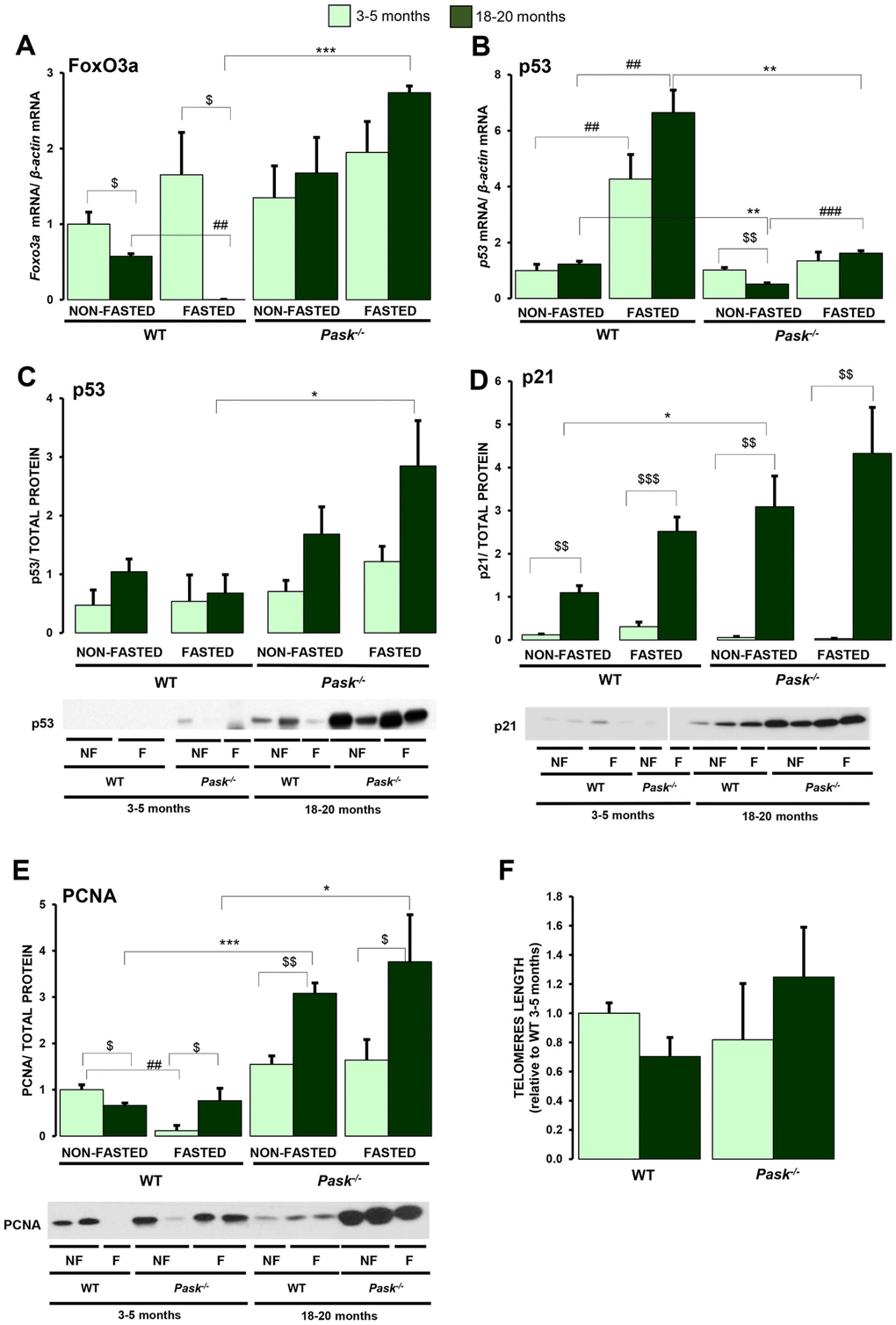 Effects of aging and PASK deficiency on the expression of FoxO3a gene and p53, p21, PCNA proteins and the length of telomeres. Real-time PCR was used to analyze the expression of FoxO3a (A) and p53 (B) mRNA levels. The results were measured in the livers of non-fasted (NON-FASTED) and 24-h fasted (FASTED) young (3-5 months) and aged (18-20 months) wild-type (WT) and PASK-deficient (Pask-/-) mice. The mRNA levels of different genes were normalized by the mRNA of β-actin used as housekeeping gene. Immunoblot analysis of p53 (C), p21 (D), PCNA (E) in livers from young and aged WT and Pask-/- mice. Liver lysates from non-fasted (NF) and 24-h fasted (F) mice were processed for western blot analysis. (C, D) The value obtained in 18-20-months-old non-fasted aged WT mice was taken as 1. (E, F) The value obtained in 3-5-month-old non-fasted WT mice was taken as 1. Bar graphs represent the means ± SEM of the densitometric values normalized by total protein detected by Stain-Free (TOTAL PROTEIN) (Supplementary Figure 3) n = 4-5 animals per condition. In addition, telomere length (F) was measured in livers from young and aged WT and Pask-/- mice. $P $$P $$$P vs. 18-20 months; * P P P vs. Pask-/-; ##P ###P vs. fasted.