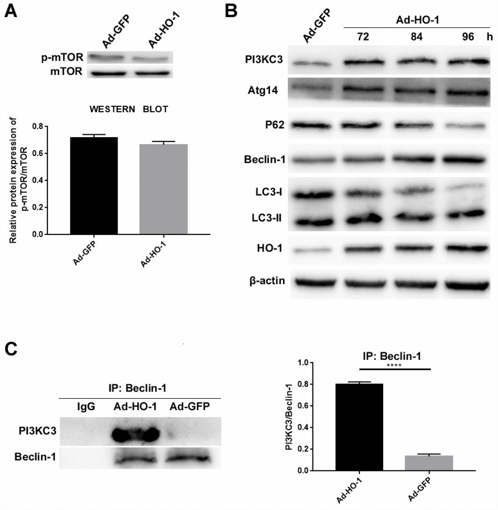 HO-1 overexpressing NPCs show elevated levels of the Beclin-1/PI3KC3 complex. (A) Western blot shows the protein levels of phospho-mTOR in NPCs transfected with Ad-HO-1 and Ad-GFP. As shown, phospho-mTOR levels are comparatively similar in both Ad-HO-1 and Ad-GFP groups. (B) Western blot analysis of HO-1, PI3KC3, Atg14, Beclin-1, P62 and LC3-II/I protein levels in NPCs cultured for 72 h, 84 h or 96 h after Ad-HO-1 transfection. (C) Immunoprecipitation assay results show the amount of Beclin-1/PI3KC3 complex in HO-1 overexpressing NPCs compared with controls. Briefly, the cell lysates were immunoprecipitated (IP) with the anti-Beclin-1 antibody and the immunoprecipitated proteins were analyzed by western blotting using the anti-PI3KC3 antibody. Note: Data are represented as mean ± SD of three independent experiments; ****p