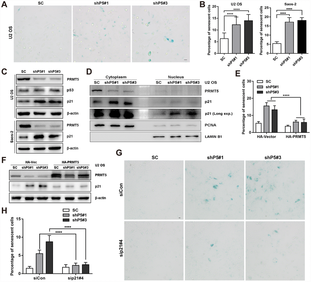 Downregulation of PRMT5 elicits cellular senescence in OS. (A) Two independent shRNAs targeting PRMT5 (shP5#1 and shP5#3) were applied to knock down PRMT5 expression in OS cell lines, and senescent cells were assessed using a SA-β-gal staining kit. Scale bar = 20 μm. (B) The percentage of senescent cells was quantified from three independent experiments, and the data are presented as the means ± SDs. ****, pC) The protein expressions of p53 and p21 with or without PRMT5 depletion in OS cells were determined by WB. (D) Cytoplasmic and nuclear proteins were prepared and then determined by WB. PCNA and LAMIN B1 were used as controls. (E) Plasmids encoding HA-PRMT5 were transfected into the SC, shP5#1 or shP5#3 U2 OS cells, and the percentage of senescent cells was quantified. ****, pF) Plasmids encoding HA-PRMT5 were transfected into SC, shP5#1 or shP5#3 U2 OS cells, the expressions of PRMT5 and p21 were then determined by WB. (G–H) siRNA targeting p21 (sip21#4) was transfected into SC, shP5#1 or shP5#3 U2 OS cells for 3 days, the senescent cells were visualized using a SA-β-gal staining kit. Scale bar = 10 μm. The percentage of senescent cells was quantified. ****, p