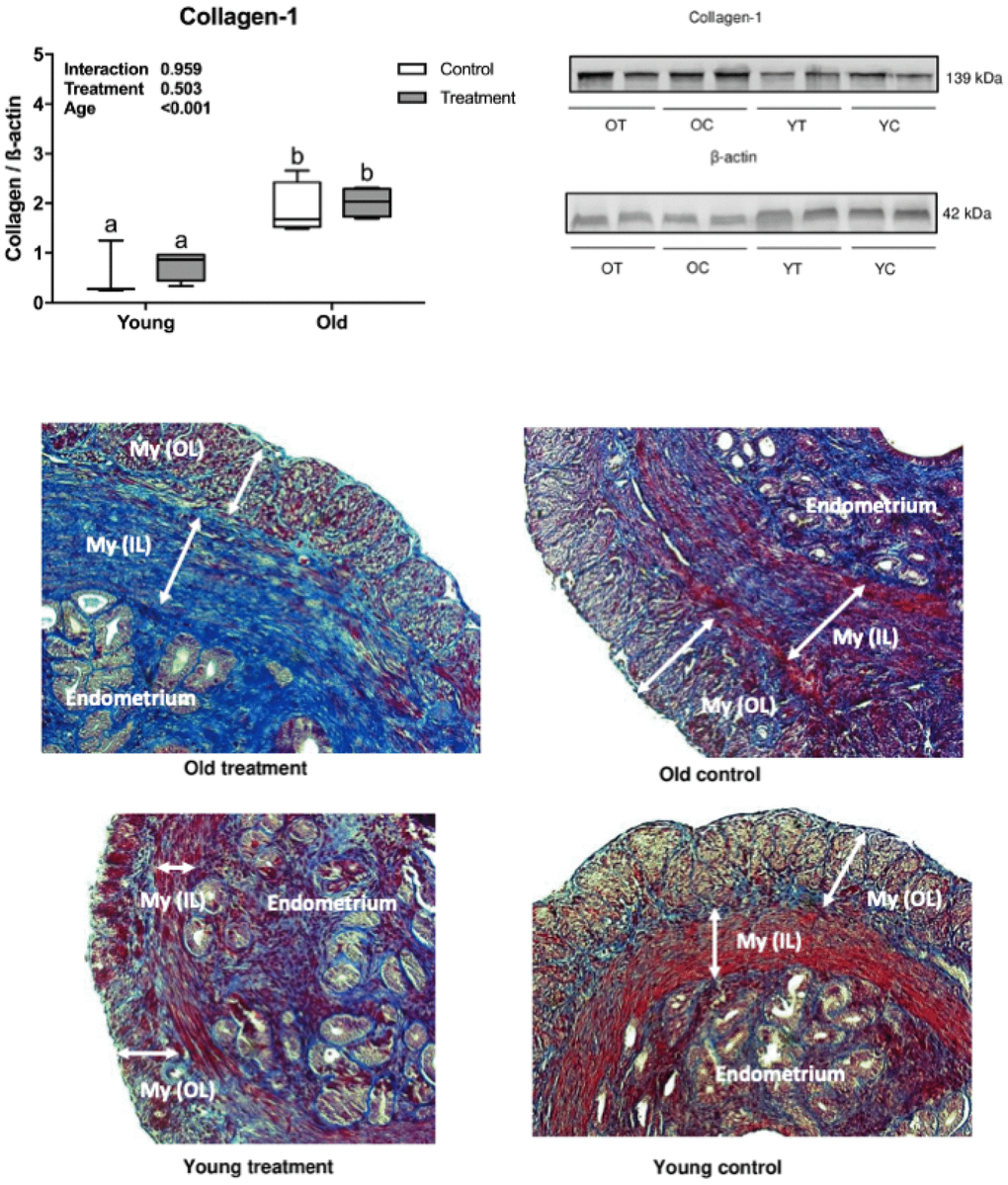 Uterine type 1 collagen deposition evaluation. (A) Collagen-1 statistical Western Blot analysis, letters indicate differences between groups (PB) Collagen-1 and β-actin Western Blot bands. (C) Representative Masson’s Trichrome stained images of uterine tissue. OT: old treatment (n=4); OC: old control (n=4); YT: young treatment (n=4); YC: young control (n=4). My (OL): myometrium (outer layer); My (IL): myometrium (inner layer). Fibrosis are stained in blue.