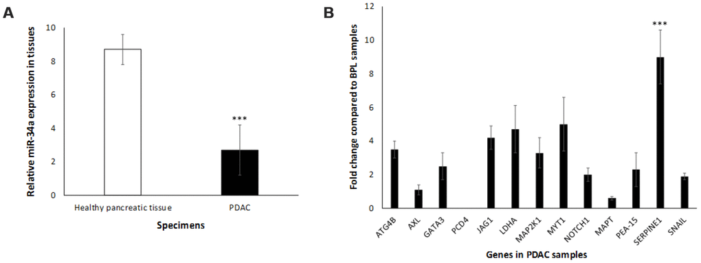 Expression profile of miR-34a in human PDAC samples. (A) miR34-a expression levels are lower in PDAC specimens compared to healthy pancreas controls. We compared the expression of miR-34a in 10 specimens in each group. Student t test was performed to compare groups. Two-tailed P value of 0.05 or less was considered statistically significant. ***p B) qRT-PCR was conducted to determine the expression of miR-34a-target genes in human PDAC or healthy pancreas control specimens. Expression of miR-34a-target genes in human PDAC and healthy pancreas control specimens were detected by qRT-PCR using specific primers and SYBR green detection as per standard protocols. Bars represent average ± s.d. of three individual experiments. Two-tailed P value of 0.05 or less was considered statistically significant; ***p 