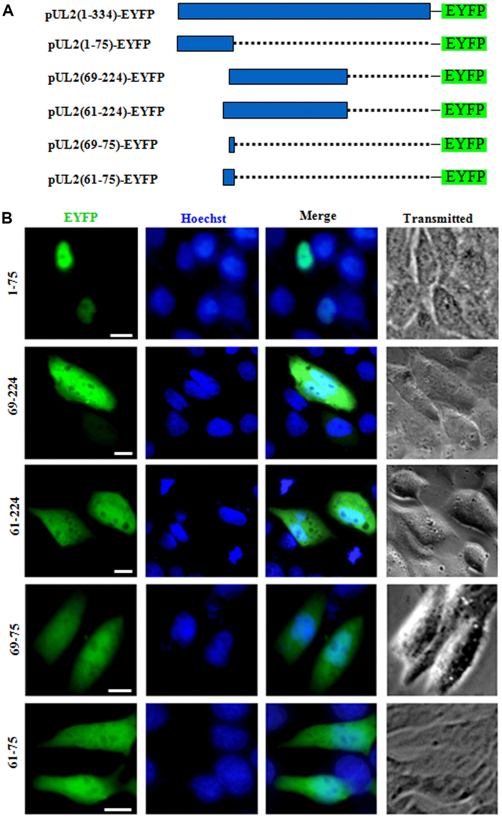 The predicted NLS2 of UL2 is nonfunctional. (A) Schematic representation of WT UL2 and its deletion mutants UL2(1-75), UL2(69-224), UL2(61-224), UL2(69-75) and UL2(61-75) fused with EYFP. (B) Subcellular localization of these UL2 deletion mutants (shown in A) in plasmid-transfected live COS-7 cells. All scale bars indicate 10 μm.