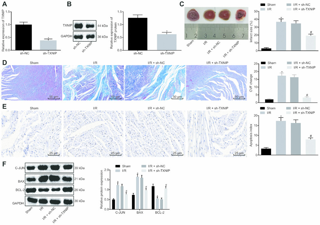 TXNIP knockdown impedes myocardial remodeling of rats with I/R. (A) TXNIP expression in myocardium determined by RT-qPCR. (B) TXNIP protein expression in myocardium normalized to GAPDH determined by Western blot analysis. (C) The myocardial infarct size detected by TTC staining. (D) The myocardial collagen detected by Masson's staining (200 ×). (E) The cardiomyocyte apoptosis detected by TUNEL staining (400 ×). (F) The protein expression of apoptosis-related factors (c-Jun, Bax and Bcl-2) normalized to GAPDH determined by Western blot analysis. * p vs. the sham group (sham-operated rats); # p vs. the I/R + sh-NC group (I/R rats treated with sh-NC). Measurement data were presented as mean ± standard deviation. Comparison between two groups was analyzed by non-paired t-test. n = 12.