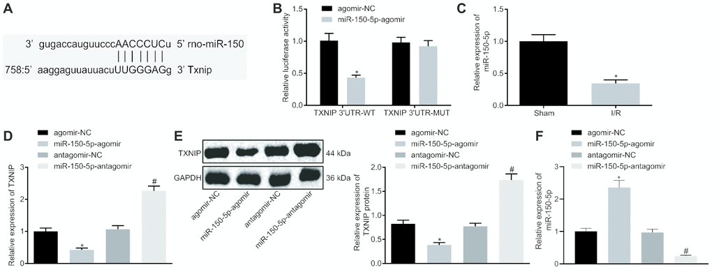 TXNIP is the target of miR-150-5p. (A) The binding sites between miR-150-5p and TXNIP as predicted by microrna.org. (B) The relative luciferase activity determined by dual-luciferase reporter gene assay. (C) The miR-150-5p expression in myocardium determined by RT-qPCR, normalized to U6; * p vs. the sham group (sham-operated rats); n =12. (D) The mRNA expression of TXNIP in myocardium determined by RT-qPCR, normalized to GAPDH. (E) The protein expression of TXNIP in myocardium normalized to GAPDH determined by Western blot analysis. (F) The expression of miR-150-5p in cardiomyocytes in response to miR-150-5p-agomir and miR-150-5p-antagomir determined by RT-qPCR. * p vs. the agomir-NC group (I/R rats treated with agomir-NC); # p vs. the antagomir-NC group (I/R rats treated with antagomir-NC). Measurement data were presented as mean ± standard deviation. Comparison between two groups was analyzed by unpaired t-test. The cell experiment was repeated 3 times independently.