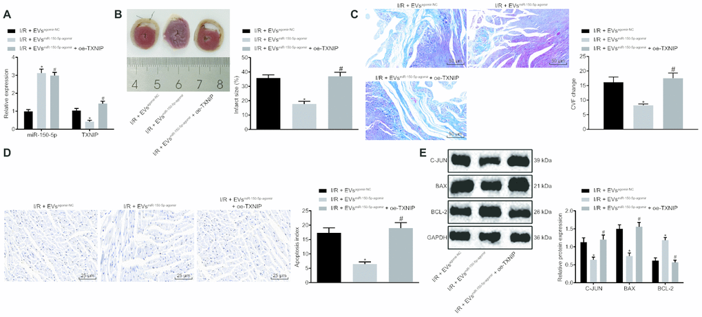 The EVs-loaded with miR-150-5p/TXNIP mediates myocardial remodeling after I/R. (A) The transduction efficiency detected by RT-qPCR. (B) The myocardial infarct size detected by TTC staining. (C) The myocardial collagen detected by Masson's staining (200 ×). (D) The cardiomyocyte apoptosis detected by TUNEL staining (400 ×). (E) The protein expression of apoptosis-related factors (c-Jun, Bax and Bcl-2) normalized to GAPDH determined by Western blot analysis. * p vs. the I/R + EVagomir-NC group (I/R rats treated with EVagomir-NC); # p vs. the I/R + EVmiR-150-5p-agomir group (I/R rats treated with EV miR-150-5p-agomir). Measurement data were presented as mean ± standard deviation. Comparison among multiple groups was analyzed by one-way analysis of variance, followed by Tukey’s post hoc test. n = 12.