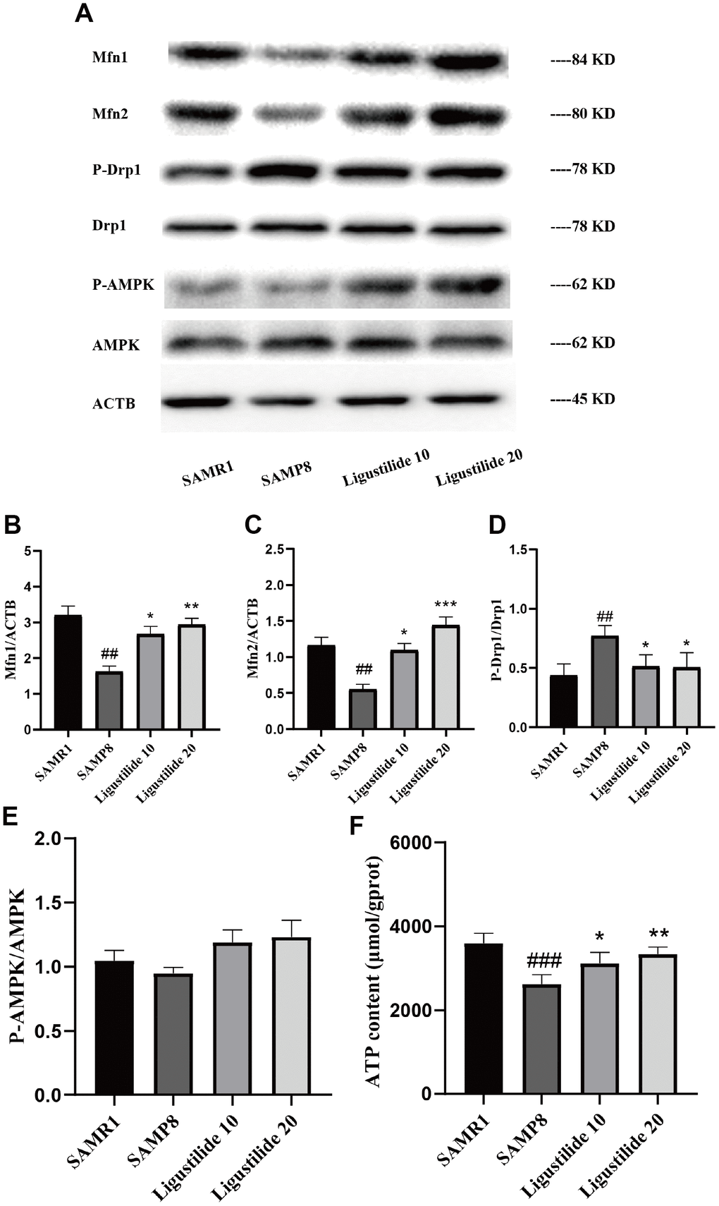 Ligustilide ameliorates mitochondrial morphology in SAMP8 mice. (A) The levels of (B) Mfn1, (C) Mfn2, (D) P-DRP1, DRP1, (E) P-AMPK and AMPK were detected in the hippocampus. (F) The expression of ATP was detected in the hippocampus. Ligustilide 10 (10 mg/kg/d); Ligustilide 20 (20 mg/kg/d). Data represent mean ± SD (n = 20 per group). #p p p p p p 