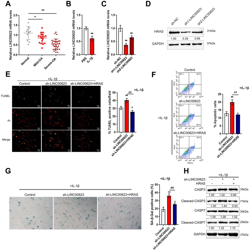 LINC00623 upregulates HRAS to suppress IL-1β-induced chondrocyte apoptosis and senescence. (A) LINC00623 expression in normal, mild OA and severe OA tissues was examined using real-time PCR assays. (B) OA chondrocytes were treated with PBS or IL-1βand then examined for LINC00623 expression using real-time PCR. (C) LINC00623 knockdown was achieved by transfection of sh1-LINC00623 or sh2-LINC00623, as confirmed using real-time PCR. (D) OA chondrocytes were cotransfected with sh1/2-LINC00623 and the HRAS vector in the presence or absence of IL-1β treatment and the protein levels of HRAS. (E, F) The cell apoptosis was examined using TUNEL and flow cytometer assays. (G) The SA-β-Gal positive cells were determined by the SA-β-Gal staining. (H) The protein levels of Caspase 3, cleaved-Caspase 3, Caspase 7 and cleaved-Caspase 7 were examined using immunoblotting. The data are presented as mean ± SD of three independent experiments. *PPPP