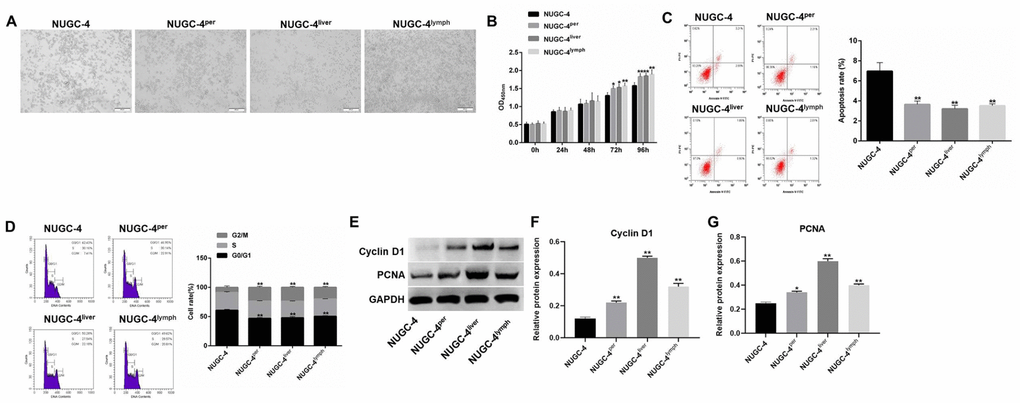 Metastatic gastric cancer cells exhibited more malignant behavior than primary gastric cancer cells in vitro. (A) The morphology of primary or metastatic NUGC-4 cells was observed under a microscope. (B) A CCK-8 assay was used to detect the viability of NUGC-4 (control), peritoneal metastatic NUGC-4 (NUGC-4per), liver metastatic NUGC-4 (NUGC-4liver) and lymph metastatic NUGC-4 (NUGC-4lym) cells at 0, 24, 48, 72 and 96 h. (C) A flow cytometer was used to detect the apoptosis of NUGC-4, NUGC-4per, NUGC-4liver and NUGC-4lym cells that had been incubated for 48 h. (D) A flow cytometer was used to detect the cell cycle distribution of NUGC-4, NUGC-4per, NUGC-4liver and NUGC-4lym cells that had been incubated for 48 h. (E–G) The relative levels of Cyclin D1 and PCNA in primary or metastatic gastric cancer cells were detected by western blotting. *P**P