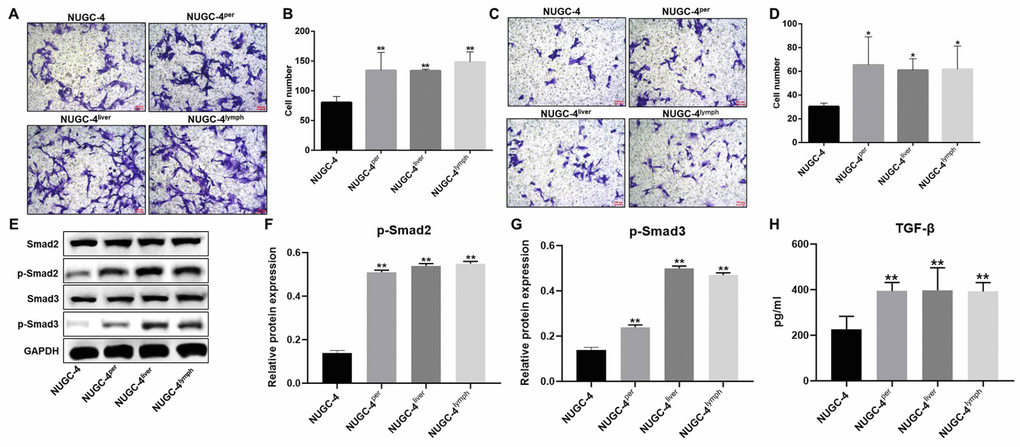 Metastatic gastric cancer cells were more invasive than primary gastric cancer cells in vitro. (A, B) NUGC-4, NUGC-4per, NUGC-4liver and NUGC-4lym cells were incubated for 48 h, and their migration was investigated by a Transwell assay. (C, D) A Transwell assay was used to investigate the invasion of NUGC-4, NUGC-4per, NUGC-4liver and NUGC-4lym cells. (E–G) The relative levels of p-Smad2 and p-Smad3 in metastatic or primary gastric cancer cells were detected by western blotting. (H) The levels of TGF-β in supernatants of metastatic or primary gastric cancer cells were detected by ELISA. *P**P