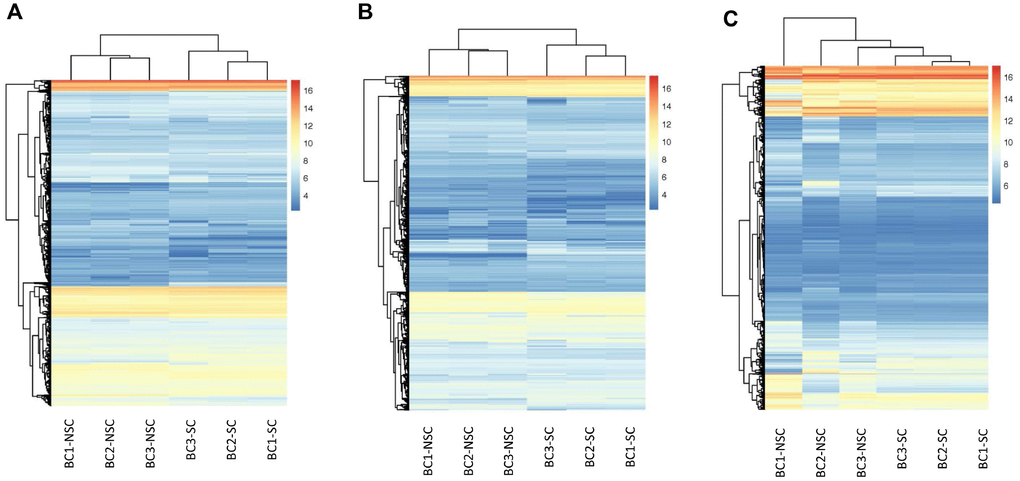 Hierarchical Clustering of all Expressed mRNAs, lncRNAs, circRNAs. Unsupervised hierarchical clustering of expressed mRNAs (A), lncRNAs (B), and circRNAs (C) from 3 pairs (BCSC vs BCNSC) of bladder cancer samples. Both expression data and sample clustering were done using average linkage and uncentered pearson correlation metric by Cluster 3.0, and results were visualized by TreeView.