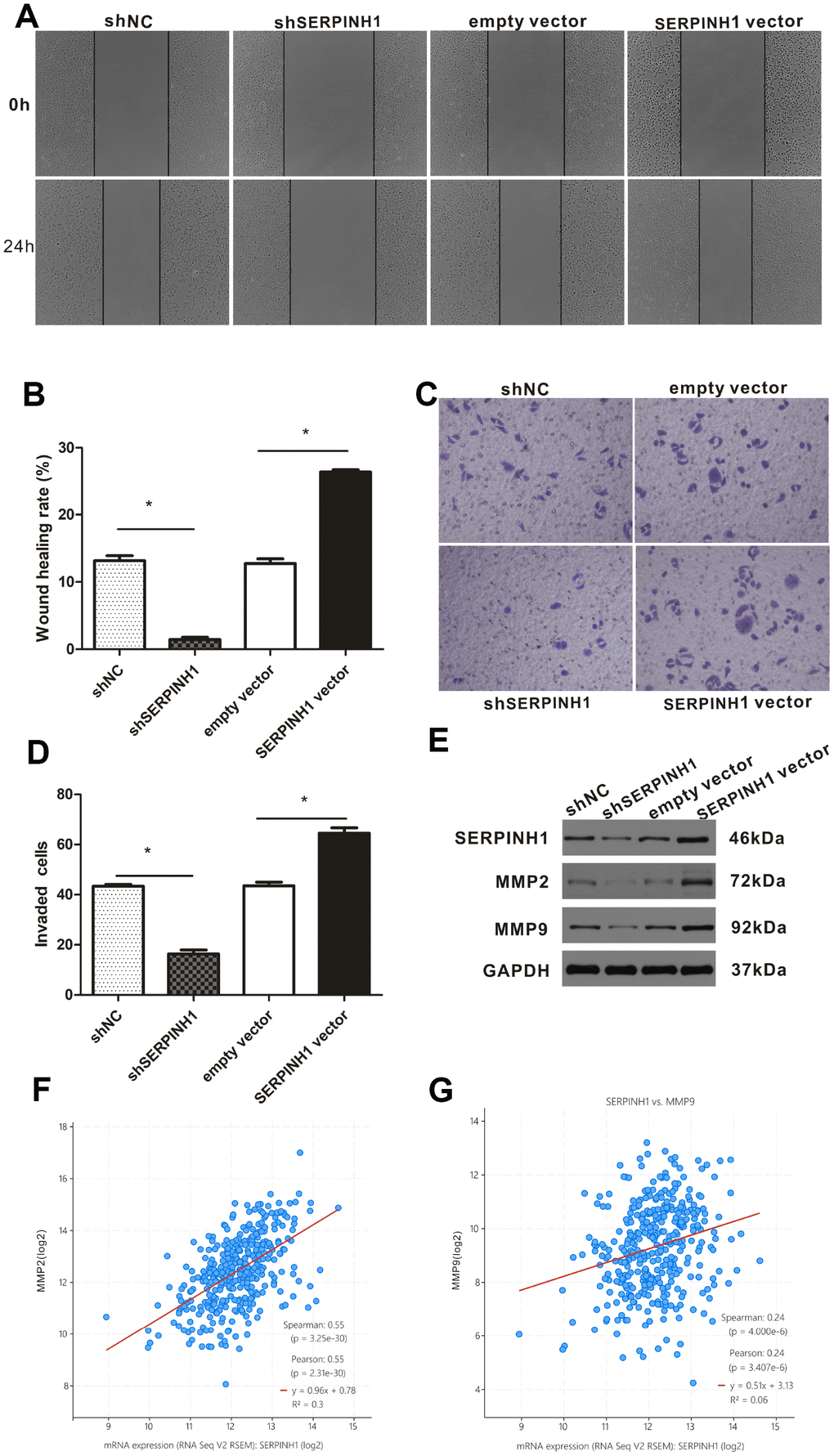 SERPINH1 expression regulates in vitro migration and invasion of GC cells. (A) Wound healing assay shows that the distance between wound edges was higher in SERPINH1-silenced SGC-7901 cells than in the control SGC-7901 cells at 24 h. Conversely, the distance between wound edges was significantly lower in the SERPINH1-overexpressing MGC-803 cells than in the control MGC-803 cells at 24 h. (B) Quantitative analysis of wound healing assay in the control and SERPINH1-silenced SGC-7901 cells, as well as control and SERPINH1-overexpressing MGC-803 cells. (C) Representative images show results of the Transwell migration assay, and (D) histogram plots show the number of migrating cells in the control and SERPINH1-silenced SGC-7901 cells, as well as control and SERPINH1-overexpressing MGC-803 cells. As shown, migration is reduced in SERPINH1-silenced SGC-7901 cells and increased in SERPINH1 overexpressed MGC-803 cells compared with the corresponding controls. (E) Western blot analysis shows that MMP2 and MMP9 protein levels are significantly reduced in the shSERPINH1-silenced SGC-7901 cells and increased in the SERPINH1-overexpressing MGC-803 cells compared with the corresponding controls. (F, G) Gene expression analysis shows that (F) MMP2 (r=0.55, PG) MMP9 (r=0.24, P