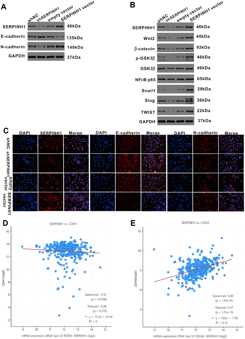 SERPINH1 regulates EMT markers and Wnt/β-catenin signaling pathway in GC. (A) Western blot analysis shows reduced N-cadherin and increased E-cadherin expression in SERPINH1-silenced SGC-7901 cells compared with controls. Conversely, SERPINH1-overexpressing MGC-803 cells show increased N-cadherin and reduced E-cadherin expression compared with the controls. (B) Western blot analysis shows increased levels of β-catenin, Wnt2, GSK-3β, p-GSK-3β, NF-κB p65, Snail1, Slug, and TWIST in the SERPINH1-overexpressing MGC-803 cells compared with the controls, whereas SERPINH1-silenced SGC-7901 cells show reduced levels of β-catenin, Wnt2, GSK-3β, p-GSK-3β, NF-κB p65, Snail1, Slug, and TWIST compared with the controls. (C) Immunofluorescence staining of E-cadherin, N-cadherin and SERPINH1 proteins in the control and SERPINH1-silenced SGC-7901 cells, as well as, control and SERPINH1-overexpressing MGC-803 cells. (D, E) Gene expression analysis of the TCGA-STAD dataset shows (D) negative correlation of CDH1 (r=-0.12, P=0.019) or E-cadherin mRNA levels and (E) positive association of CDH2 (r=0.40, P