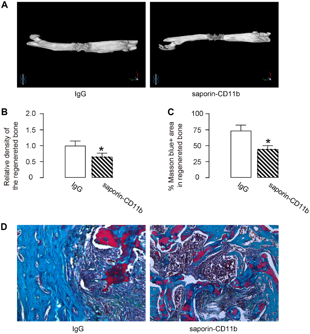 Macrophage depletion compromises DO-induced bone regeneration. Morphological histological analysis of the bone specimens was performed 14 days after removal of external fixers by micro-CT. (A, B) The density of the regenerative bone was assessed, shown by representative images (A), and by quantification (B). (C, D) Masson staining was also performed, shown by quantification (C), and by representative images (D). *p