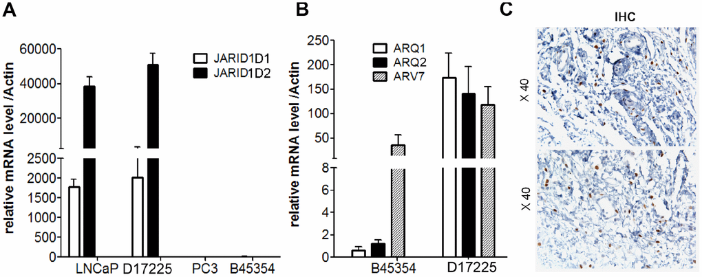 Expression of AR and JARID1D by RT-PCR analysis. (A) Expression of JARID1D in tumors tissue of different PDX models and PC cells were detected by RT-PCR. (B) Expression of AR and ARV7 in tumors tissues of different PDX models detected by RT-PCR. Data are shown as the means ± SD of three independent experiments performed in triplicate. (C) Expression of ARV7 in tumors tissues of B45354 PDX models detected by IHC. Original magnification, 400×; scale bars represent 20 μm.